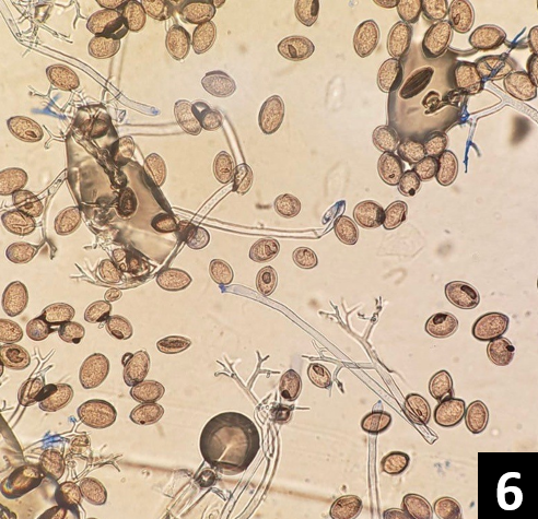 Spores under a microscope.